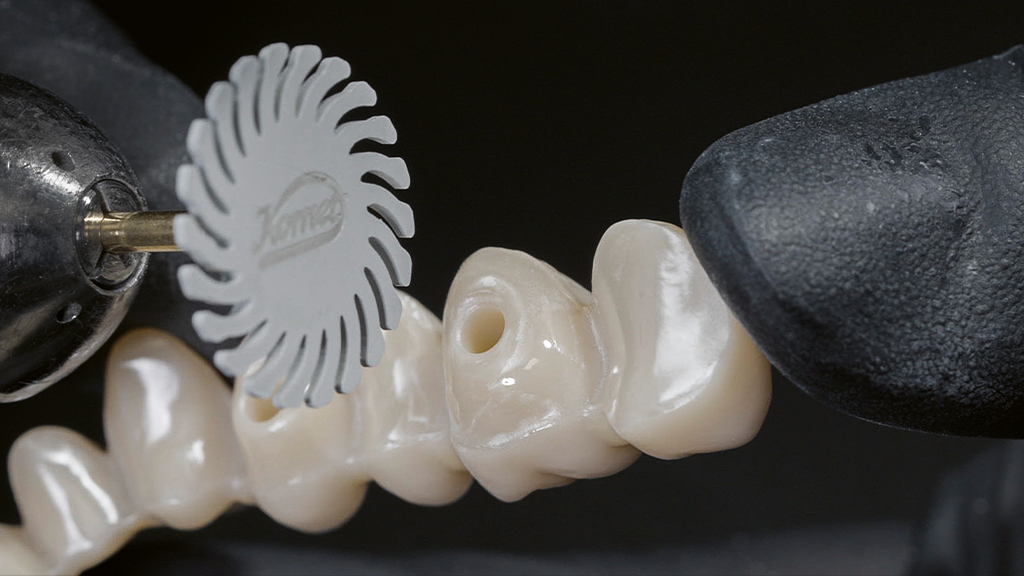 Werkstoffgerechte Bearbeitung von Zirkonoxid im Überblick: Restauration im Weißlingszustand; Ausarbeiten mit Hartmetallfräsern. Die Bearbeitung der gesinterten Brücke mit einem diamantierten Schleifkörper (DCB-Schleifer). Finishing mit einer Etna-Polierscheibe für die Hochglanzpolitur. Mehr dazu in Teil 2 und 3 mit erprobten und konkreten Insider-Tipps.