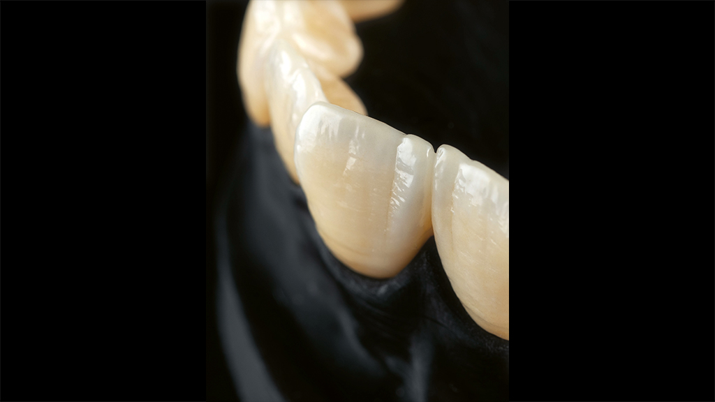 Zirkonoxid³ (Teil 1): Das Zirkonoxid-Paradox und der Multiplikator-Effekt