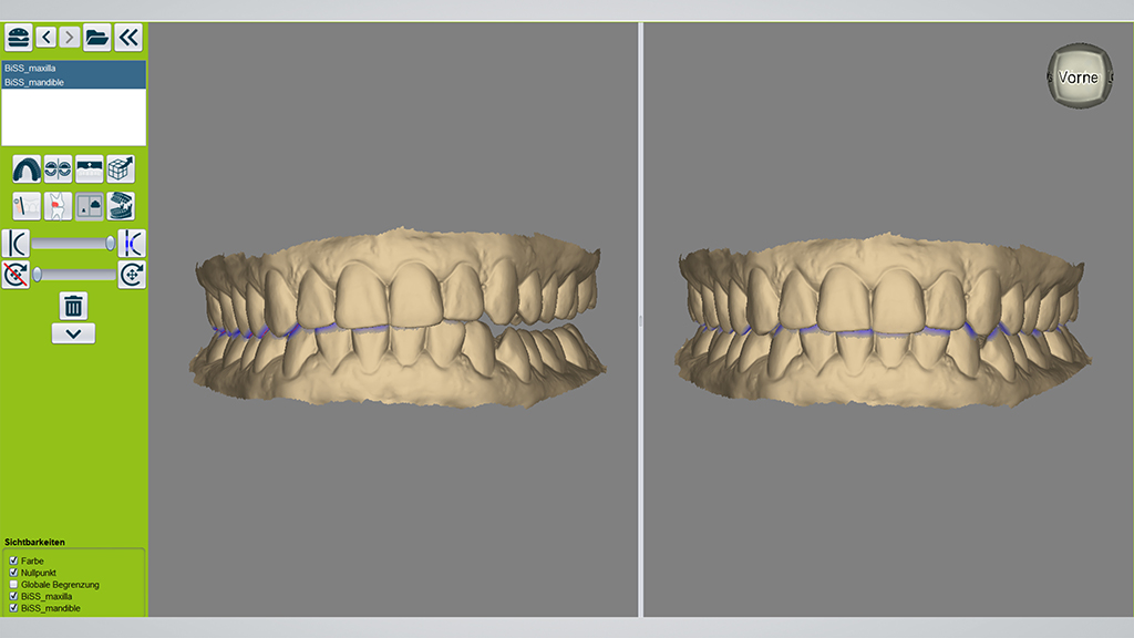 Splitscreen in Contact. Links: vor der automatischen Korrektur. Rechts: nach der automatischen Korrektur.