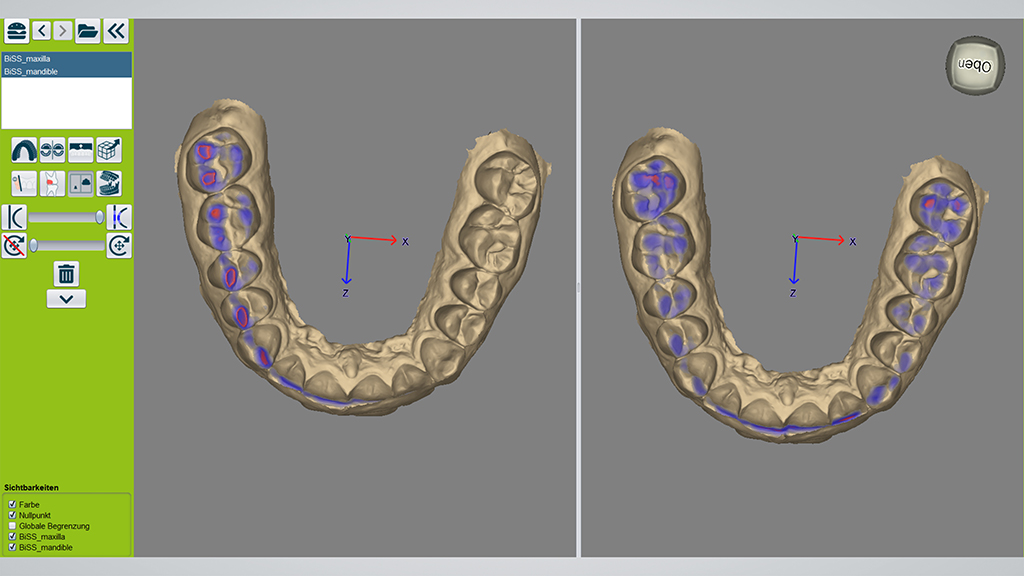 Links: farbige Kontaktpunkte vor der automatischen Korrektur. Rechts: farbige Kontaktpunkte nach der automatischen Korrektur. 